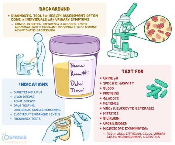 How do you pass a delta-8 urine test?