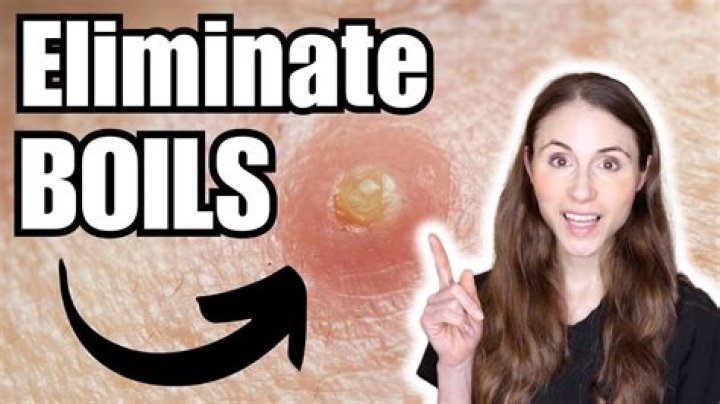 How do you pop a boil on your pubic area?